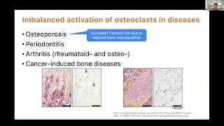 KRWebinar Intravital Imaging for monitoring osteoclast activity within hindlimb long bone [upl. by Adieren]