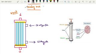 DIALYZER PARTS  HOLLOW FIBRE DIALYZER [upl. by Pol]