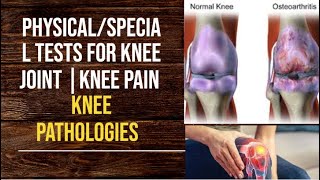 PhysicalSpecial Tests For Knee Joint  Knee Pain  Knee Pathologies  PhysiotherapyKnowledge [upl. by Ahseyn507]