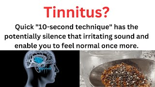 10 Second Technique to Silence Tinnitus [upl. by Apgar]