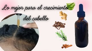 REMEDIO CASERO PARA CRECER EL CABELLO MÁS RÁPIDO [upl. by Lytsirk]