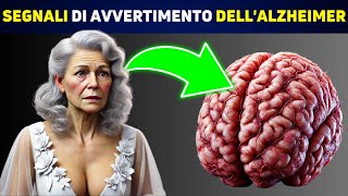 SCIENTIFICO Queste 5 Abitudini Sono Legate allAlzheimer [upl. by Murphy199]