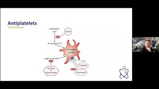 AHD Periprocedural Antithrombotic Therapy M Holmberg [upl. by Leunammi376]