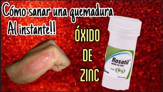 CÓMO ALIVIAR Y SANAR UNA QUEMADURA AL INSTANTE CON OXIDO DE ZINC DESDE TU HOGAR [upl. by Hazeghi]