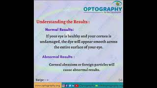 Corneal Fluorescein Staining [upl. by Laban99]