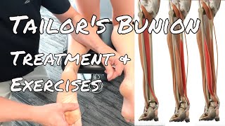 Tailors Bunion  Treatment amp Exercises [upl. by Aremus509]