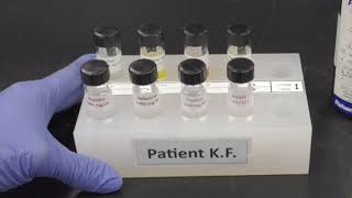 Urinalysis with Reagent Test Strips [upl. by Lammaj263]