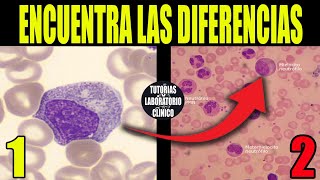 🩸Cómo Identificar Células Sanguíneas INMADURAS de la LÍNEASerie BLANCAHematología Medicina🔬 [upl. by Nedak]