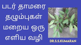 PADARTHAMARAI RINGWORM INFECTION DRSSKUMARAN [upl. by Dogs]