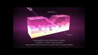 Comment agit lacide hyaluronique [upl. by Shirline]