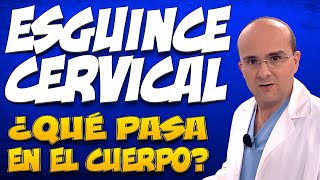 ESGUINCE CERVICAL  ¿Qué pasa en el cuerpo de quienes lo padecen [upl. by Junieta847]