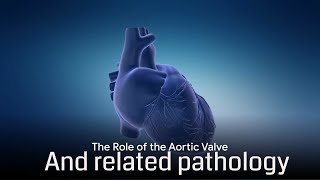 Aortic Stenosis Everything You Need To Know For The Usmle [upl. by Langan]