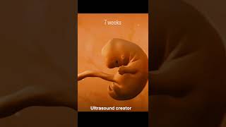 7 Weeks Babybaby doctor pregnant cutebaby health doctors pregnancy ultrasound hospital [upl. by Wren256]