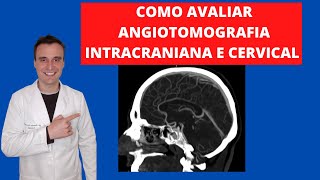 Angiotomografia arterial intra e extra craniana para residentes e estudantes de medicina [upl. by Nalat479]