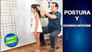 COMO CORREGIR LA POSTURA DE NIÑOS EN CASA [upl. by Balliol]