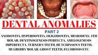 Developmental disturbances in teeth  Dental anomalies  Odontology notes  UGC NET Forensic science [upl. by Afra209]