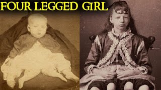 The Shocking True Story of the quotFourLegged Girlquot  Josephine Myrtle Corbin [upl. by Legra94]