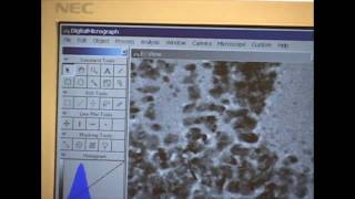 Transmission Electron Microscope Part 2 of 2 [upl. by Rama]