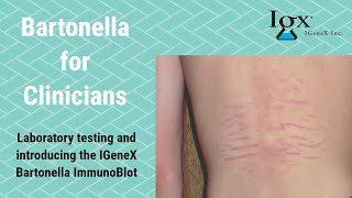 Introducing IGeneX Bartonella ImmunoBlots [upl. by Idhem]