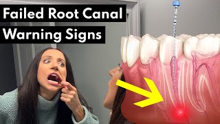 7 Warning Signs Your Root Canal FAILED [upl. by Jamesy]