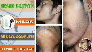 BEARD GROWTH  Get more thicken beard with minoxidil  45 days done ✅️ great results from mars kits [upl. by Nalepka321]