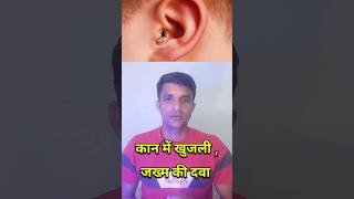 कान में खुजली जख्म की दवा।। candibiotic ear drop short shorts ytshorts youtubeshorts [upl. by Togram955]