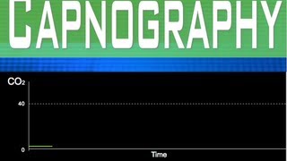 EtCO2 Capnography Part 1 [upl. by Lucia183]