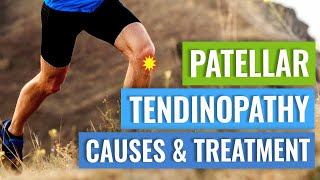 Get Relief from Patellar Tendinopathy with these Exercises [upl. by Oiratnom]