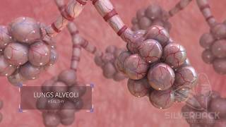 Lungs Alveoli Medical Animation [upl. by Hahsia366]