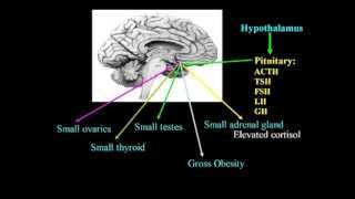 Excitotoxins Neurotoxins amp Human Neurological Disease Lecture  Dr Russell Blaylock [upl. by Ennair]