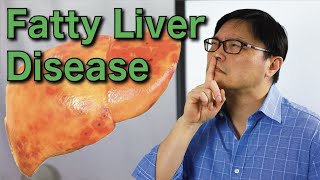 How to Reverse Fatty Liver Disease Naturally  Jason Fung [upl. by Eyk]