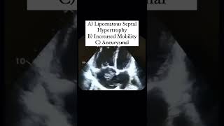 Interatrial Septum Quiz echocardiography [upl. by Ojyram]