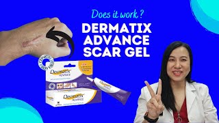 How To Reduce Scars with Dermatix Advanced Scar Gel [upl. by Kathryn]