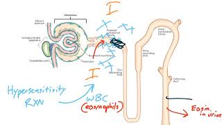 Acute Kidney Injury for the USMLE Step 1 [upl. by Gavrilla]