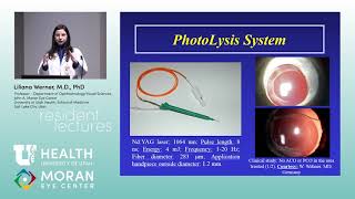 Ocular Pathology IOLs and Capsular Bag Opacification [upl. by Imaon]