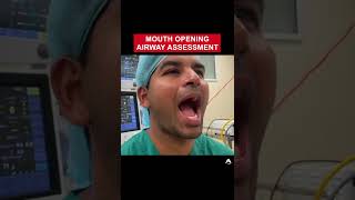 Mouth Opening Airway Assessment  shorts anaesthetics cico [upl. by Josias709]