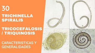 TRICHINELLA SPIRALIS 30  TRIQUINELOSIS  NEMATODOS [upl. by Ebenezer]