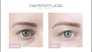 Dermatude Portfolio  Before amp After results [upl. by Yarahs]