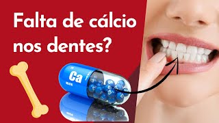 FALTA DE CÁLCIO NOS DENTES   Resumos de Odonto [upl. by Ytirehc]