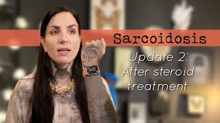 Sarcoidosis update 2 After topical steroid treatment [upl. by Utas]