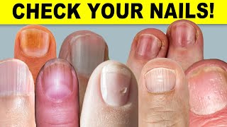 How to GROW YOUR NAILS FAST actually helpful information [upl. by Ensoll]