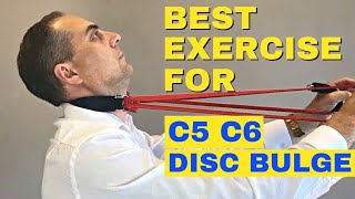 Best Exercises For C5 C6 Bulging Disc  C5 C6 Herniated Disc Exercises by Dr Walter Salubro [upl. by Larimore554]