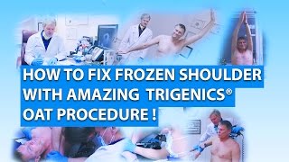 FROZEN SHOULDER CURE Trigenics Nonsurgical Operation OAT Procedure TV Show Adhesive Capsulitis [upl. by Petey]