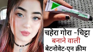 Betnovate N Cream Complete Review हिन्दी मैं Betnovate N Cream Uses amp Side effects [upl. by Irap]