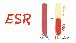 Erythrocyte Sedimentation Rate ESR What Does This Lab Test Really Mean [upl. by Diley]