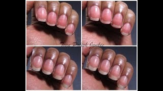 Tes ongles seront durs et vont pousser 2X plus vitepousse extreme des ongles [upl. by Mario186]