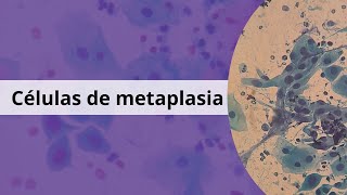 Metaplasia ¿Qué significa [upl. by Harris578]