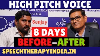 BeforeAfter High Pitch Voice Therapy  Within 8 Days  SLPSanjayKumar  Speech Pathologist India [upl. by Hanad]