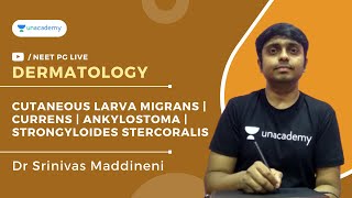 Cutaneous Larva Migrans  Currens  Ankylostoma  Strongyloides stercoralis by Dr MAddineni Srinivas [upl. by Pavla]