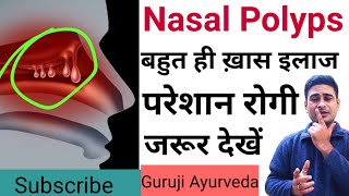 nasal polyps ka desi ilaj  nasal polyps ayurvedic treatment [upl. by Suoirrad]